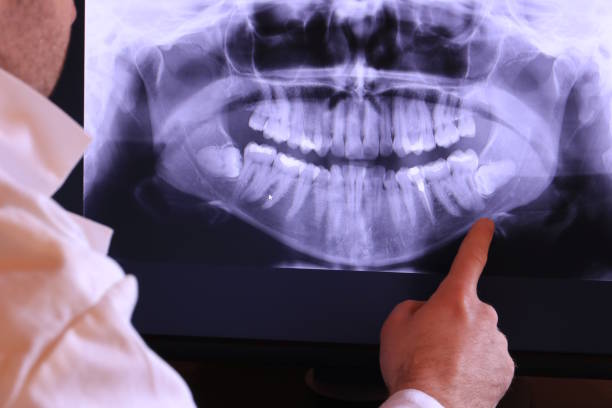 Best Weekend Emergency Dentist in Santa Rosa Valley, CA